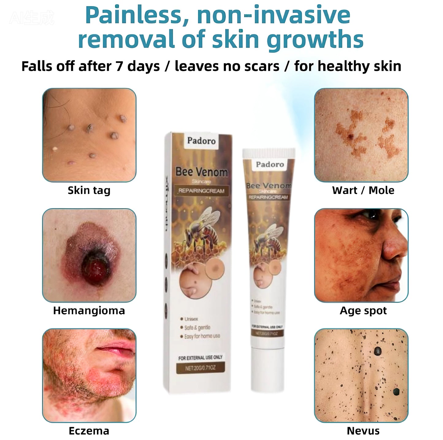 🔥Buy 1 Get 1 Free🔥Pain-free Bee Venom Wart and Tags Removoal Cream（副本）