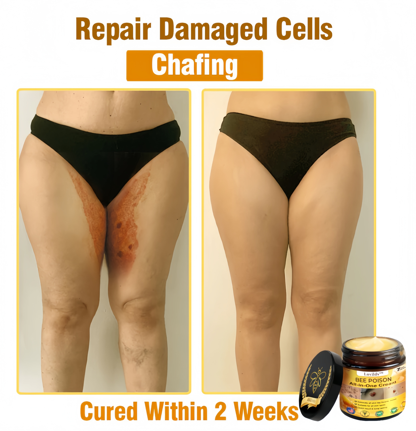 [Official Brand Store] 🏆Lovilds™ BEE POISON All-in-One Cream (✅FDA Approved & Mayo Clinic Recommended)