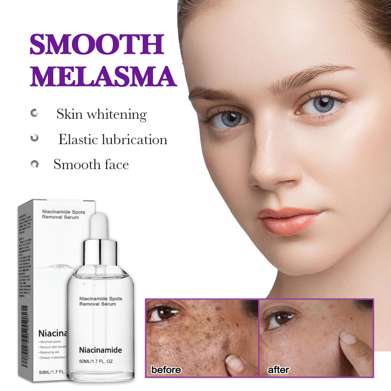 10% Niacinamide Spots Removal Serum 🎉Second Item half price🎉