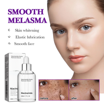 10% Niacinamide Spots Removal Serum 🎉Second Item half price🎉