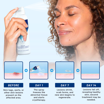 Fivfivgo® TagRecede Cryo Treatment Spray