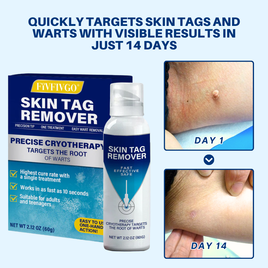 Fivfivgo® TagRecede Cryo Treatment Spray