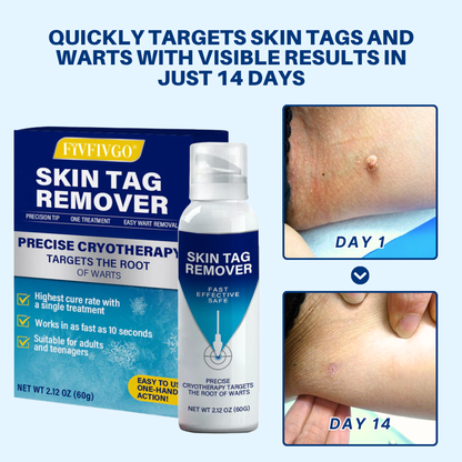 Fivfivgo® TagRecede Cryo Treatment Spray