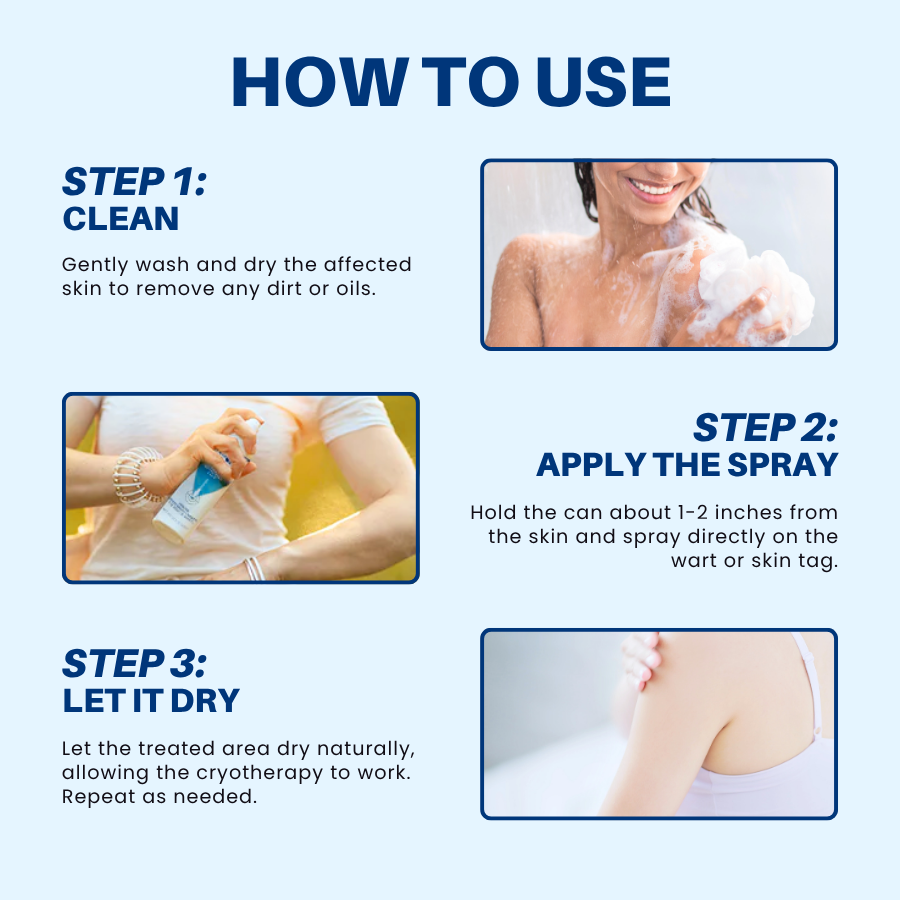 Fivfivgo® TagRecede Cryo Treatment Spray