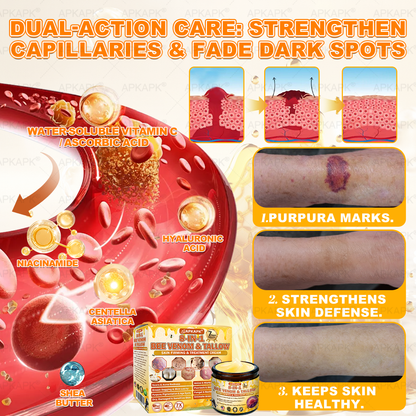 Official Store | 𝐀𝐏𝐊𝐀𝐏𝐊® 𝟖-𝐈𝐧-𝟏 𝐁𝐞𝐞 𝐕𝐞𝐧𝐨𝐦 & 𝐓𝐚𝐥𝐥𝐨𝐰 𝐒𝐤𝐢𝐧 𝐅𝐢𝐫𝐦𝐢𝐧𝐠 & 𝐓𝐫𝐞𝐚𝐭𝐦𝐞𝐧𝐭 𝐂𝐫𝐞𝐚𝐦 (Effective Within 7 Days)Bee Venom + Tallow · 7X Deep Hydration, targets wrinkles, sagging, stretch marks, dark spots, purpura, inflammations and more