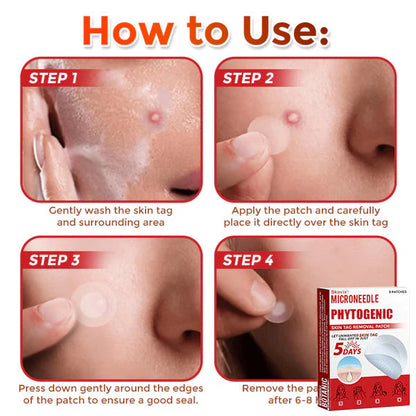 MicroNeedle Botanic Skin Tag Removal Patch ✅Australian Made
