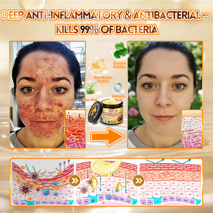 Official Store | 𝐀𝐏𝐊𝐀𝐏𝐊® 𝟖-𝐈𝐧-𝟏 𝐁𝐞𝐞 𝐕𝐞𝐧𝐨𝐦 & 𝐓𝐚𝐥𝐥𝐨𝐰 𝐒𝐤𝐢𝐧 𝐅𝐢𝐫𝐦𝐢𝐧𝐠 & 𝐓𝐫𝐞𝐚𝐭𝐦𝐞𝐧𝐭 𝐂𝐫𝐞𝐚𝐦 (Effective Within 7 Days)Bee Venom + Tallow · 7X Deep Hydration, targets wrinkles, sagging, stretch marks, dark spots, purpura, inflammations and more