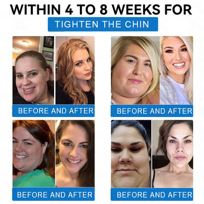 🌻Non-Invasive Night Patch for Weight Support【No Pills • Risk-Free】