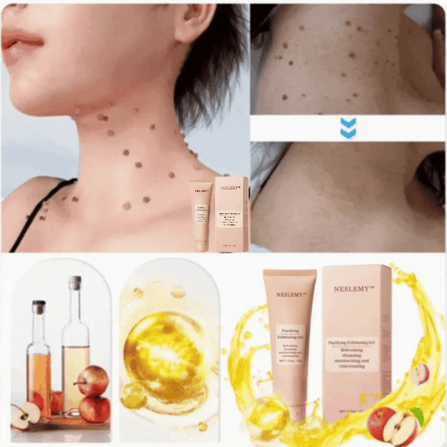 NESLEMY™ Purifying Exfoliating Gel for Acanthosis Nigricans, Exfoliation, Dark Spots, Skin Tags, and Eczema