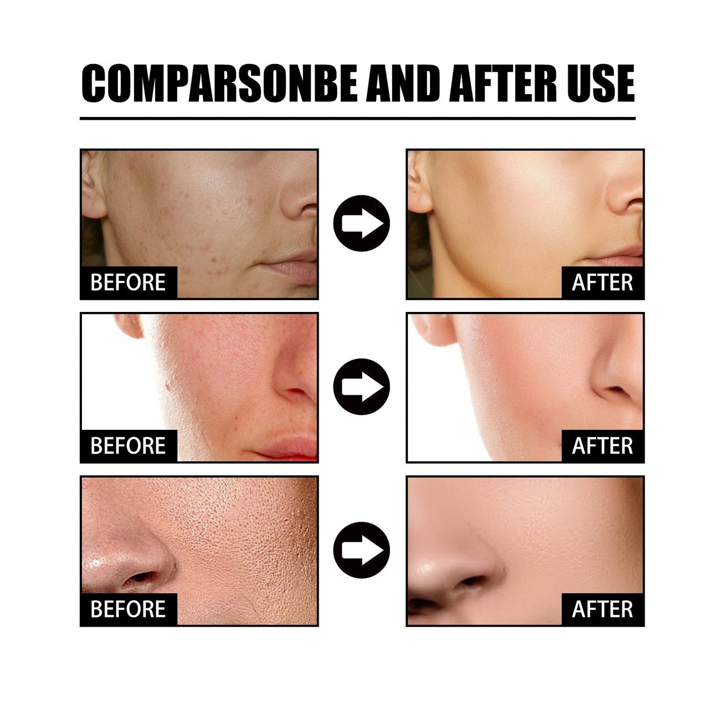 10% Niacinamide Spots Removal Serum 🎉Second Item half price🎉