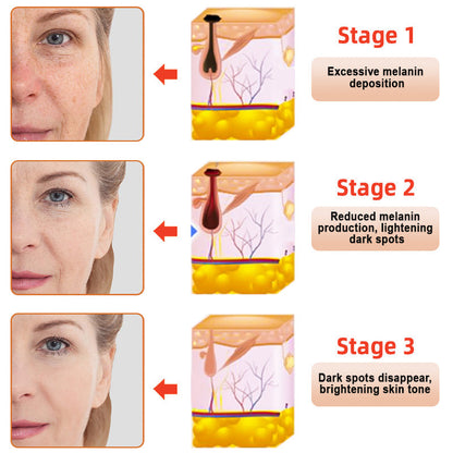 NESLEMY™ Purifying Exfoliating Gel for Acanthosis Nigricans, Exfoliation, Dark Spots, Skin Tags, and Eczema
