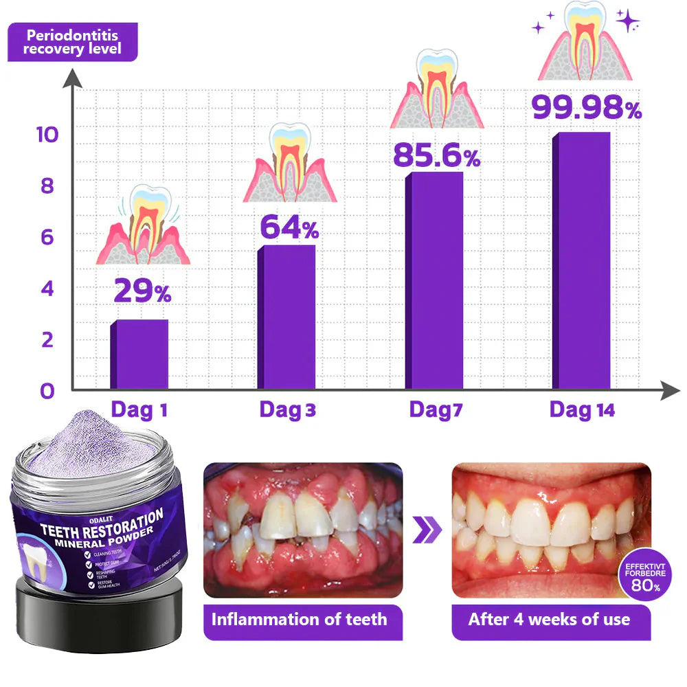 🌿Flash Sale - ODALIT™ Teeth Restoration Mineral Powder🦷(ADA recommended)👩‍⚕️(Treats periodontitis and mouth ulcers, prevents tooth loss, and repairs gum recession)