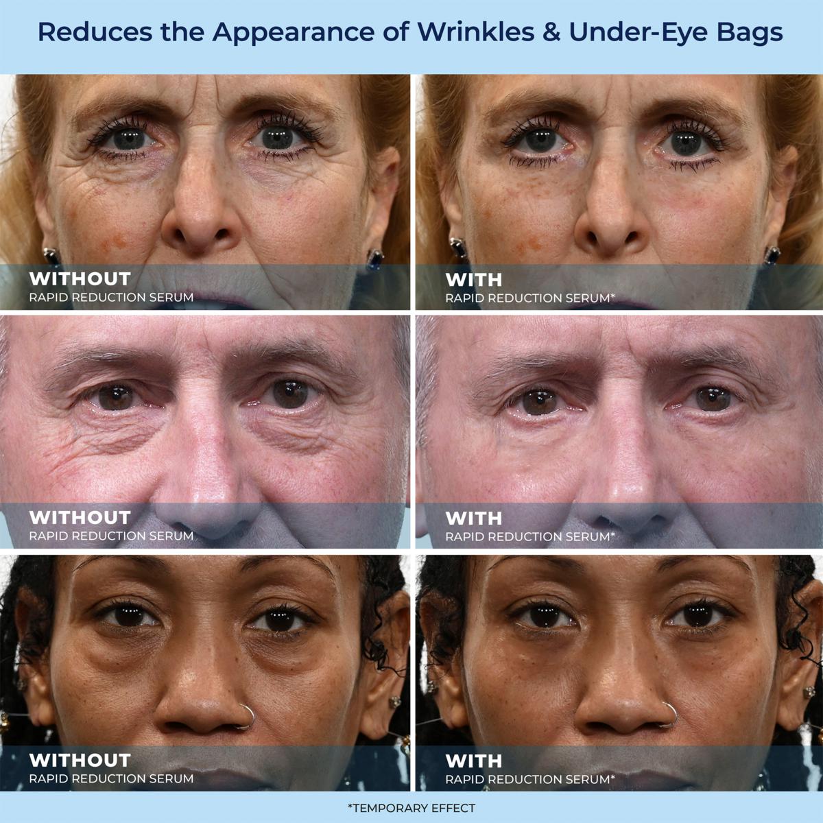 🔥Last Day Promotion 49% OFF LBMLBM™ 60-Second Anti-Aging Serum for Wrinkles, Bags & Dark Circles