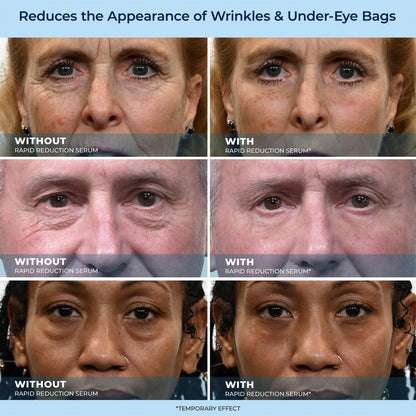 🔥Last Day Promotion 49% OFF LBMLBM™ 60-Second Anti-Aging Serum for Wrinkles, Bags & Dark Circles