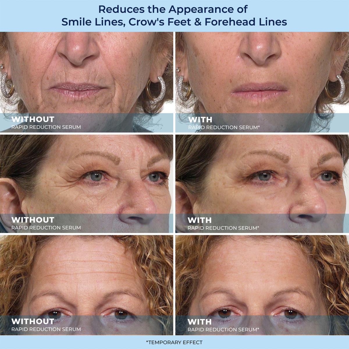 🔥Last Day Promotion 49% OFF LBMLBM™ 60-Second Anti-Aging Serum for Wrinkles, Bags & Dark Circles